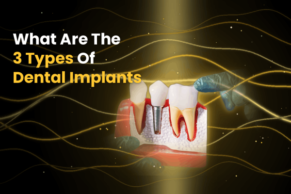 What Are The 3 Types Of Dental Implants?