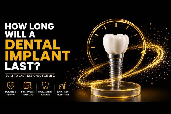 How Long Will A Dental Implant Last?