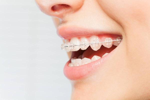 Orthodontic Services